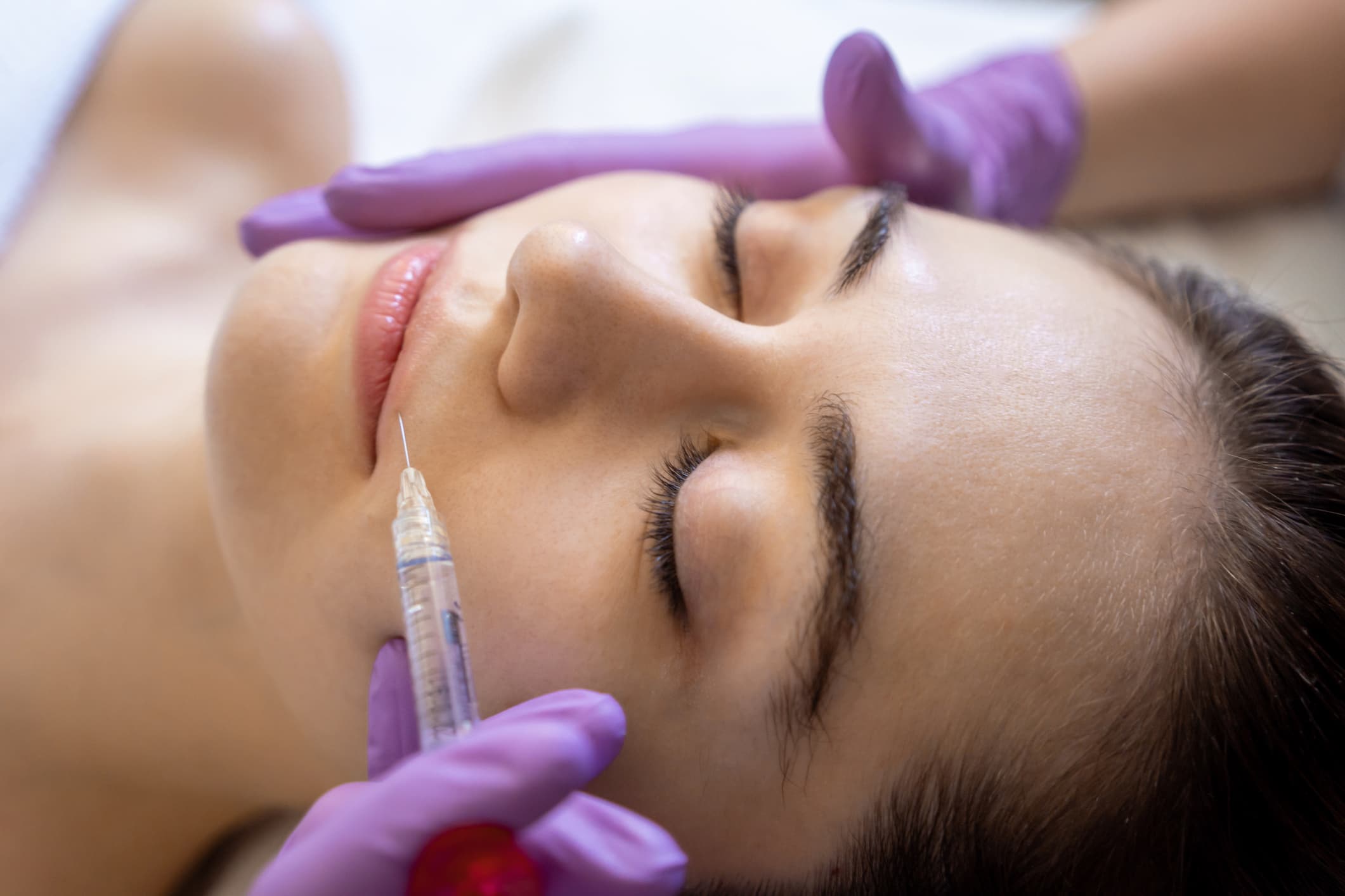 A medical aesthetician performs anti-wrinkle injections on a woman's upper lip.