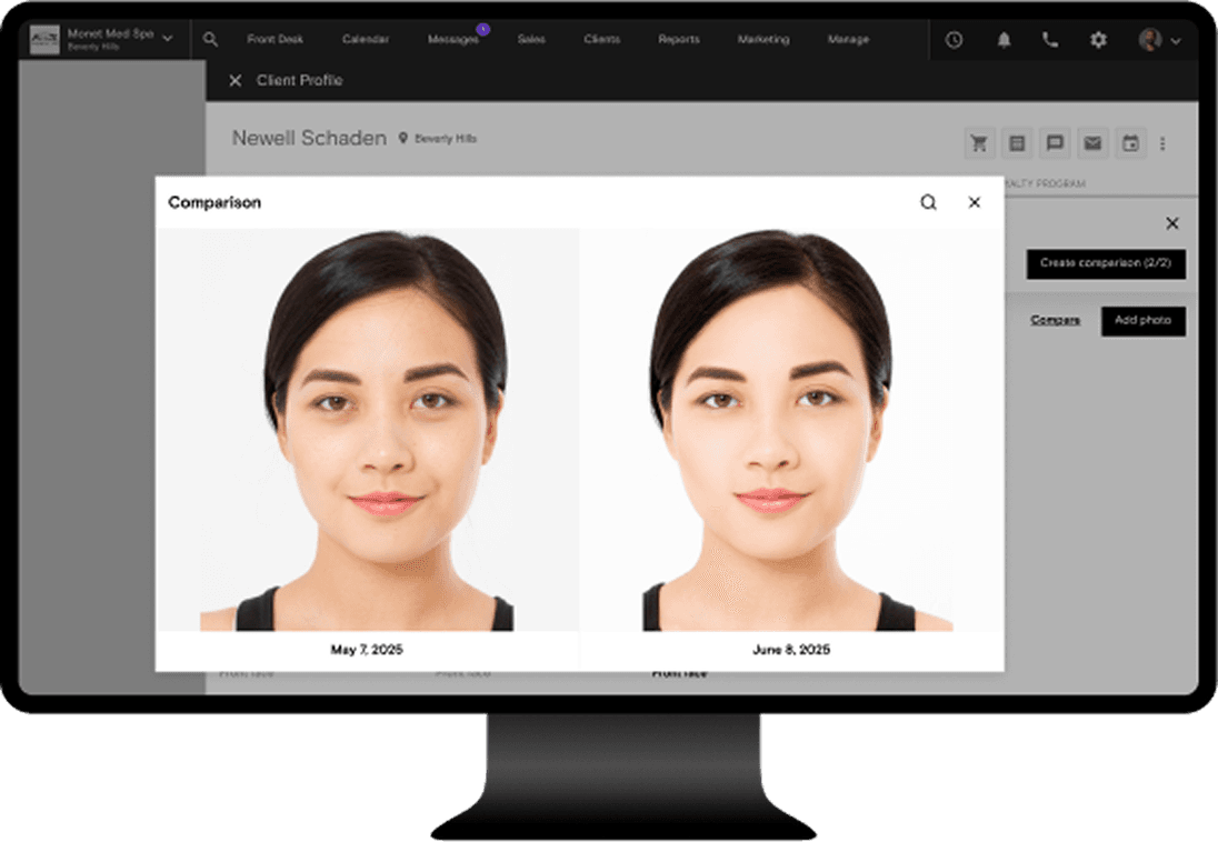 HIPAA-compliant charting and photo markups in Boulevard