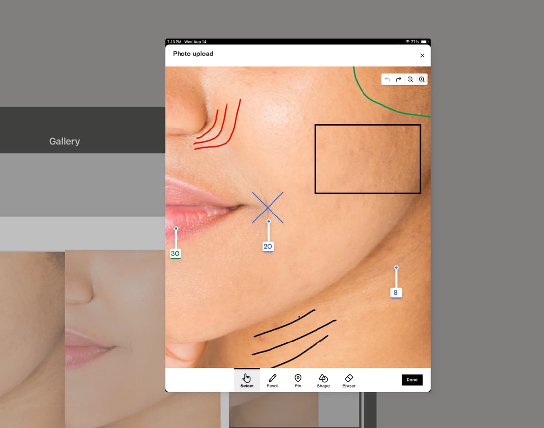 Photo markup with treatment annotations in a Boulevard client gallery