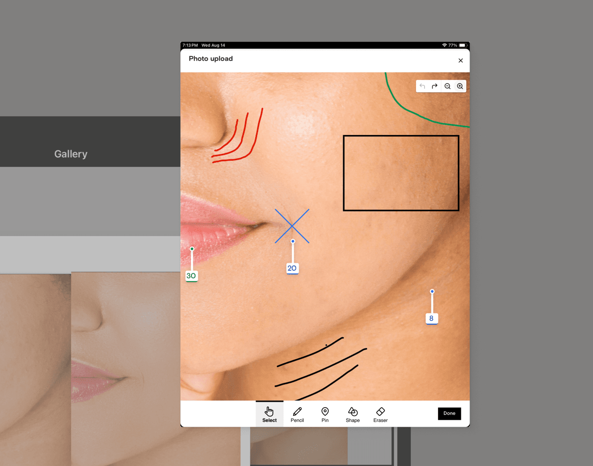 Photo markup with treatment annotations in a Boulevard client gallery