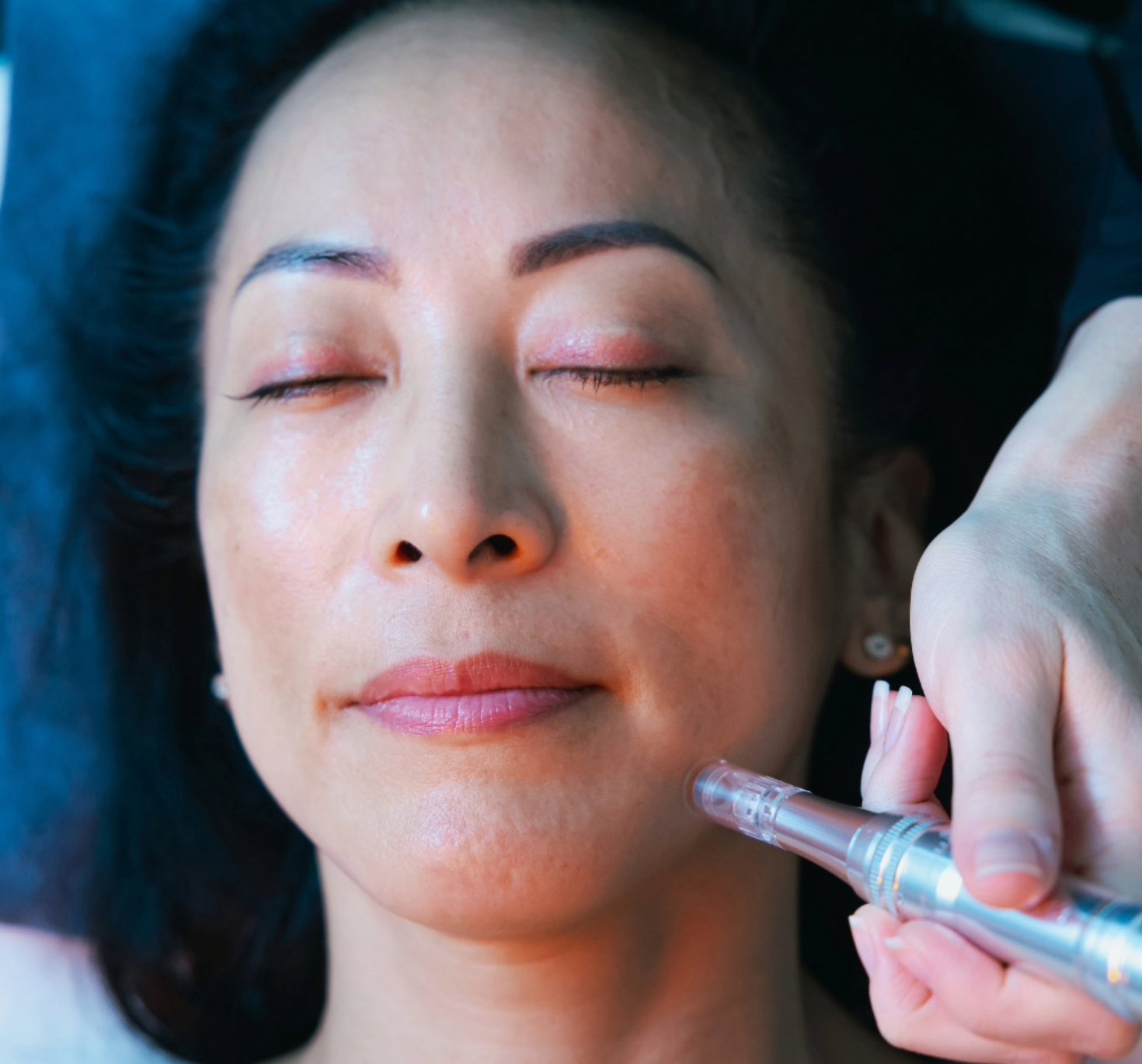 A woman lies on a table with her eyes closed as she receives a skin care treatment.