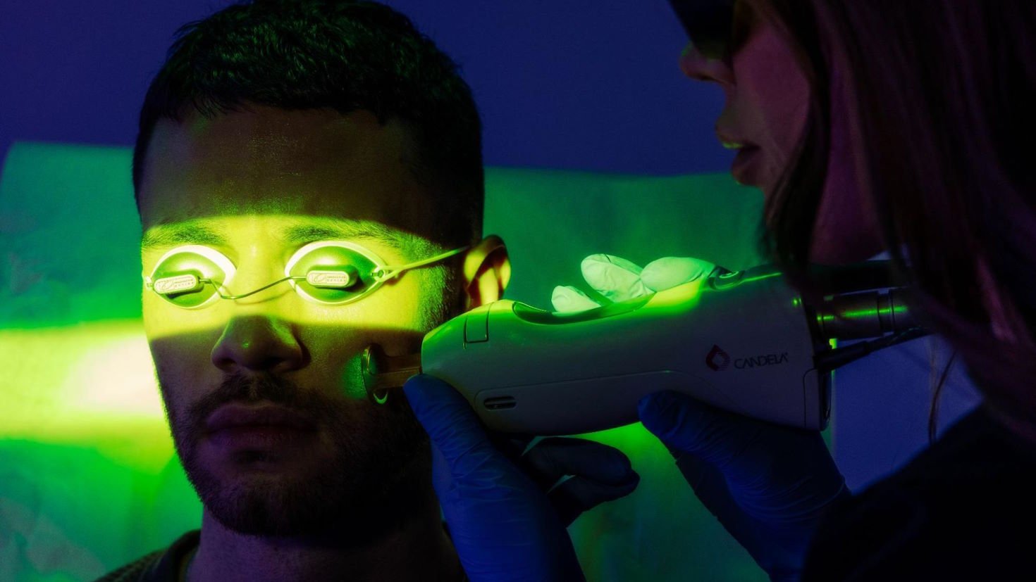 An aesthetics patient wears protective eyewear while receiving laser treatment on their face.
