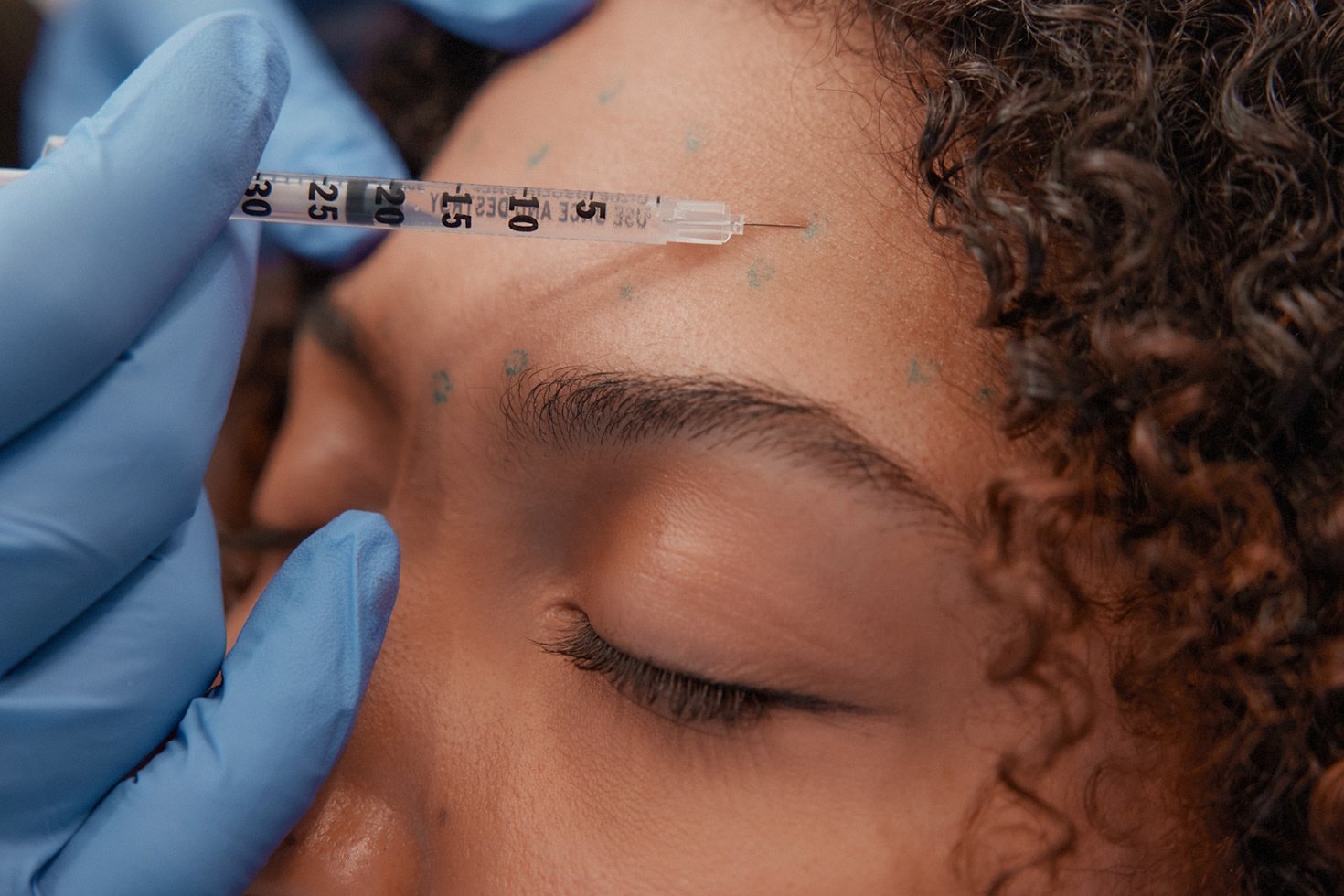 A woman receiving a facial injection