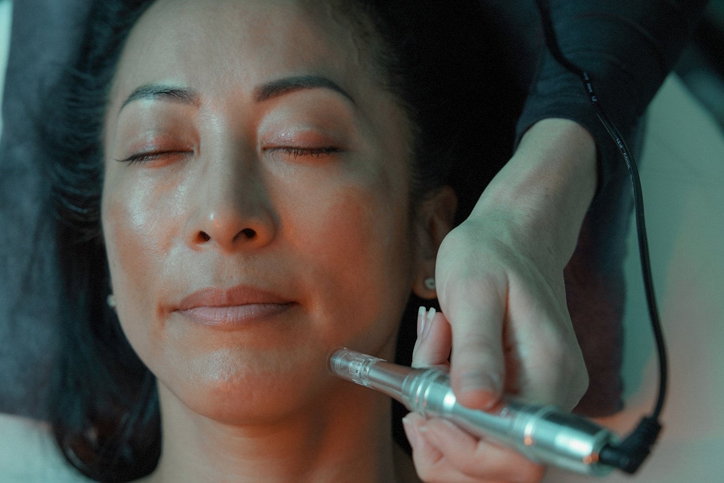 Close-up of a woman undergoing treatment on her face at a medical spa.